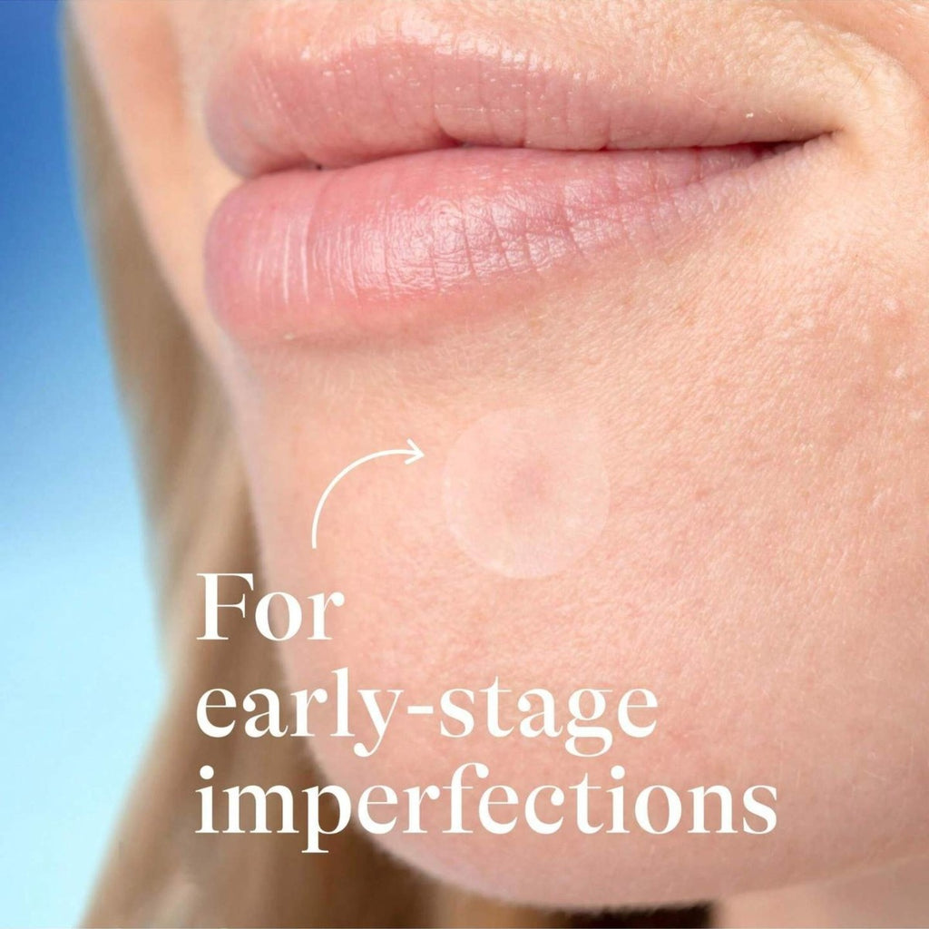 Bestselling Transparent Acne  Scar Patches